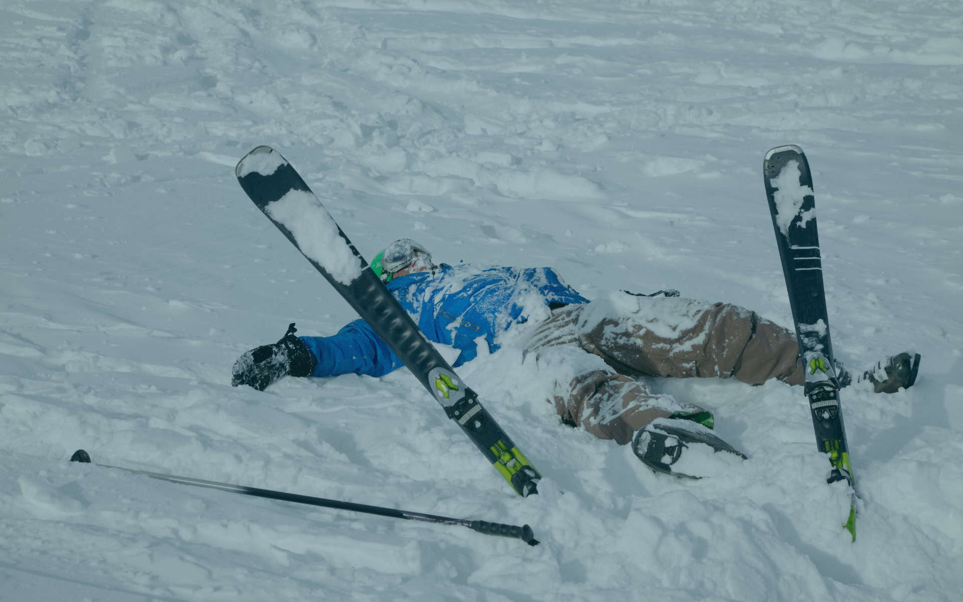 Skiunfall vor Jahren kann heute Schmerzen verursachen